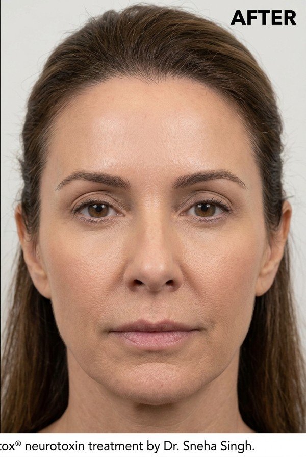 After treatment result at CliniKimaya+